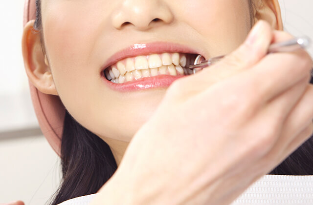 審美歯科イメージ