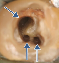 マイクロスコープ下で汚染物質・細菌を完全に除去